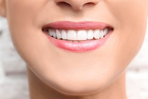 woman with beautiful teeth