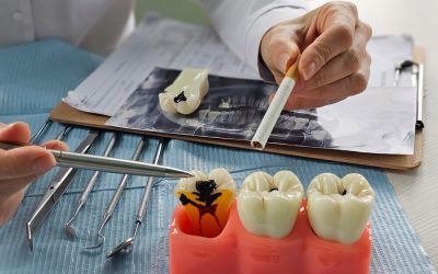 Does Smoking or Vaping Affect Implants?